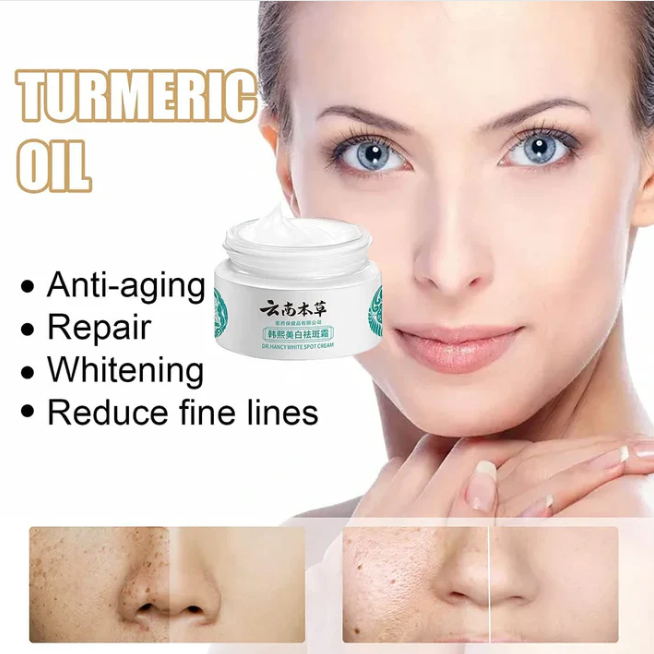 Japanese Melasma Cream