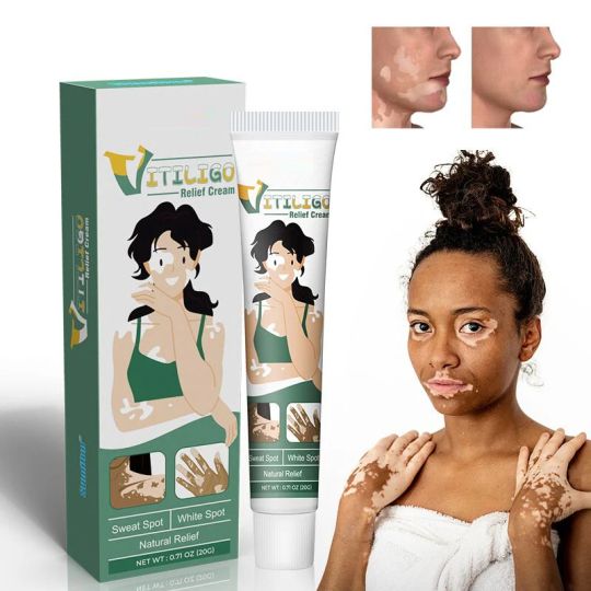 Vitiligo Relief Cream