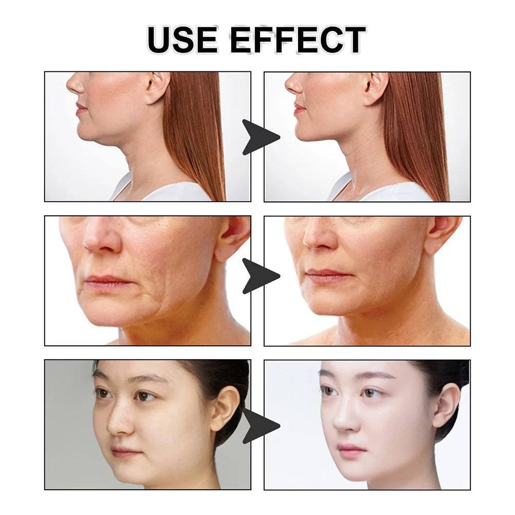 Facial Lifting Patch Face Shaping Lifting Firm Chin V-shaped Lifting Tape