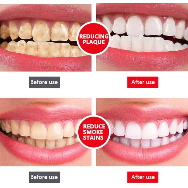 SP-4 Probiotic Whitening Toothpaste