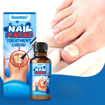 Antifungal Nail Fungi Treatment | 30ml