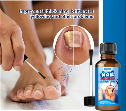 Antifungal Nail Fungi Treatment | 30ml